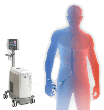 Imagen: El sistema de manejo de temperatura intravascular (IVTM) ZOLL Thermogard XP (Fotografía cortesía de ZOLL).